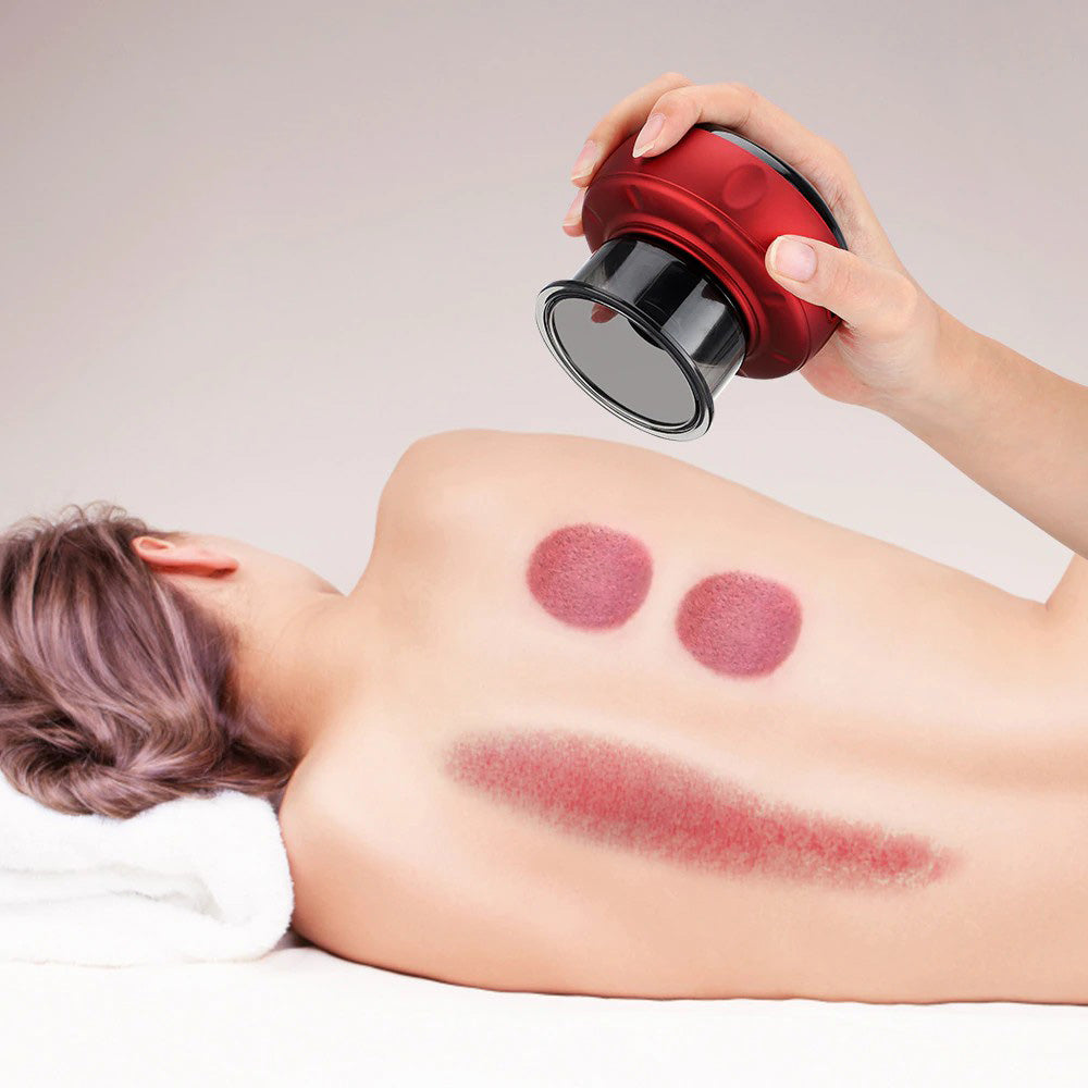 Electric Vacuum Cupping Massager